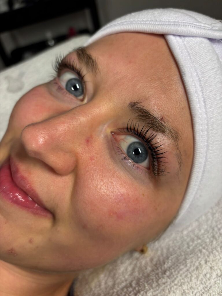 Bild zeigt Wimpernlifting in Hamburg