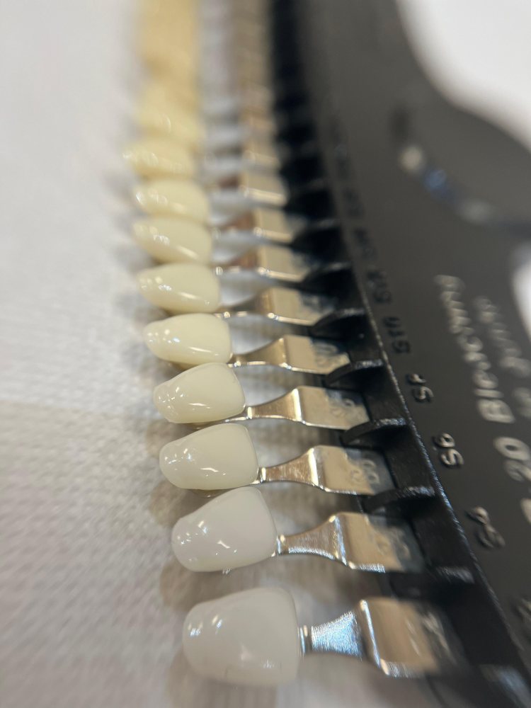 Kosmetische Zahnaufhellung in Hamburg Harburg (2)