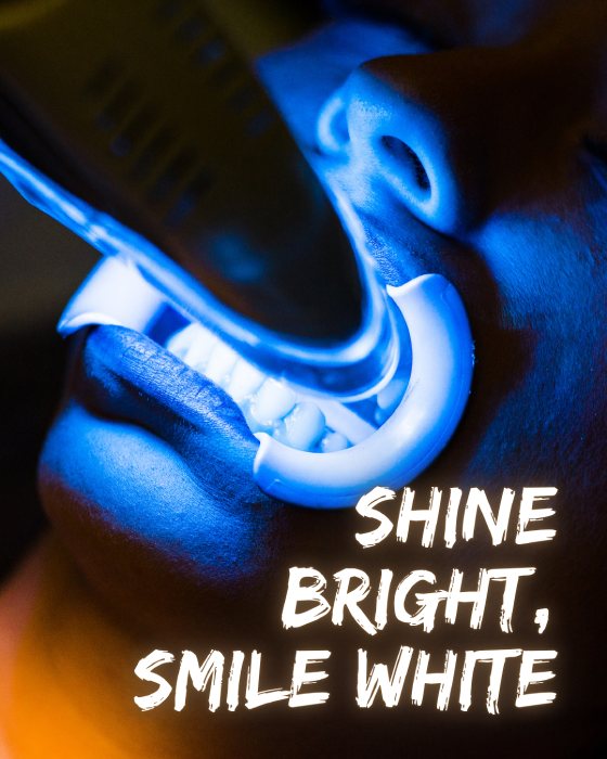 Kosmetische Zahnaufhellung in Hamburg Harburg